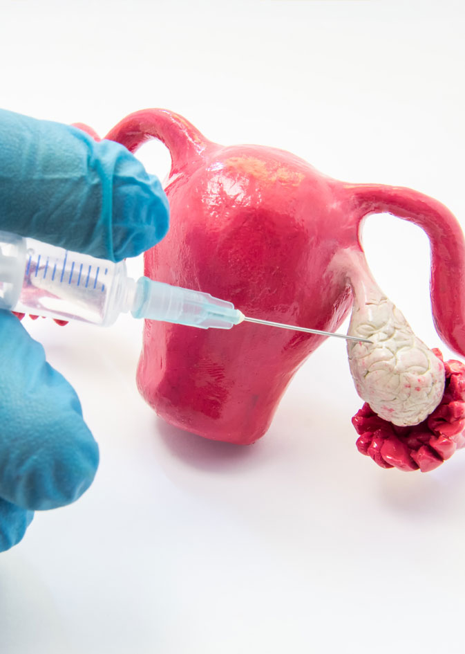 Subfertility Images Male Subfertility | Male Infertility Treatment in Singapore
