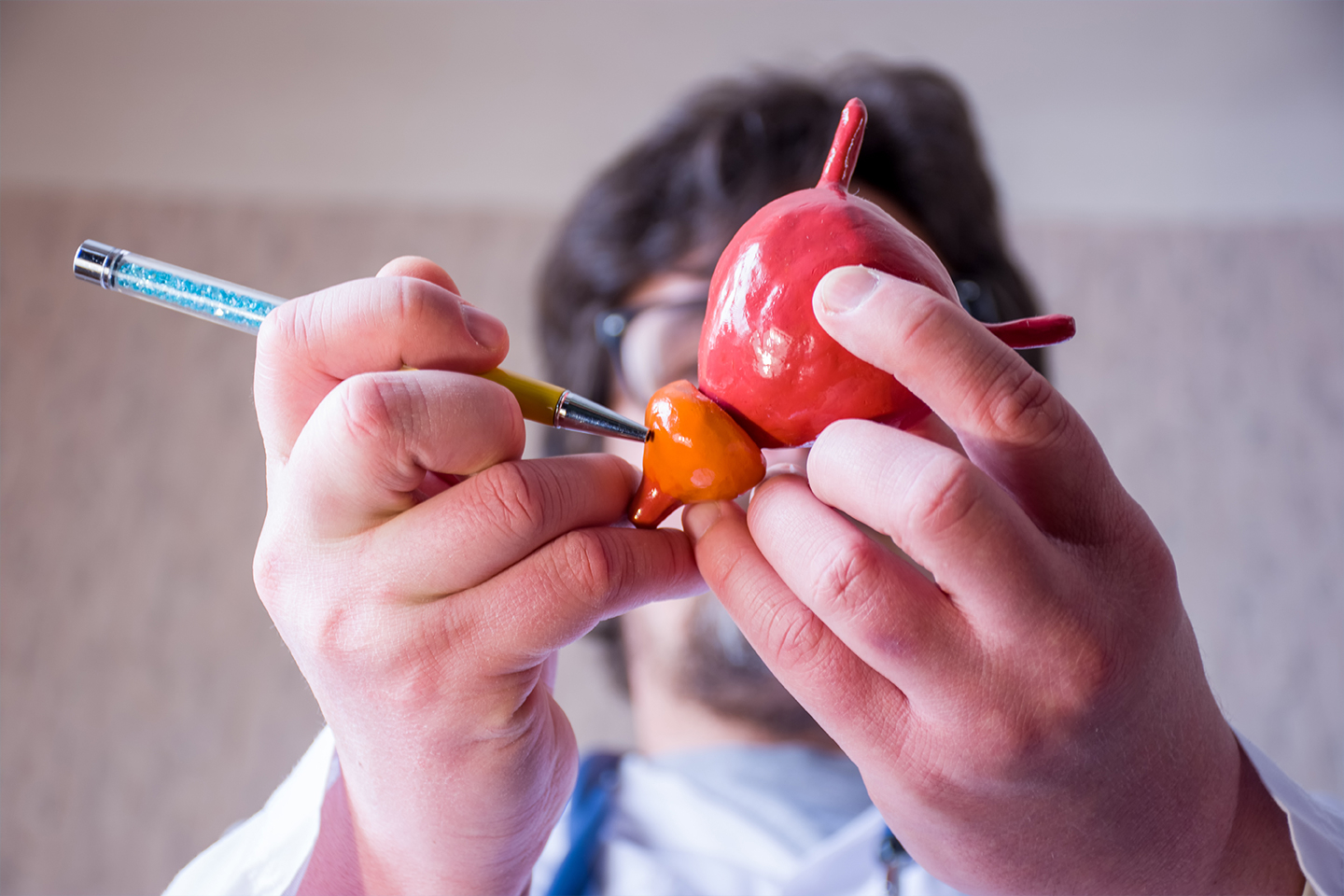 Doctor holding a model of prostate with bladder, pointing to the prostate with a pen
