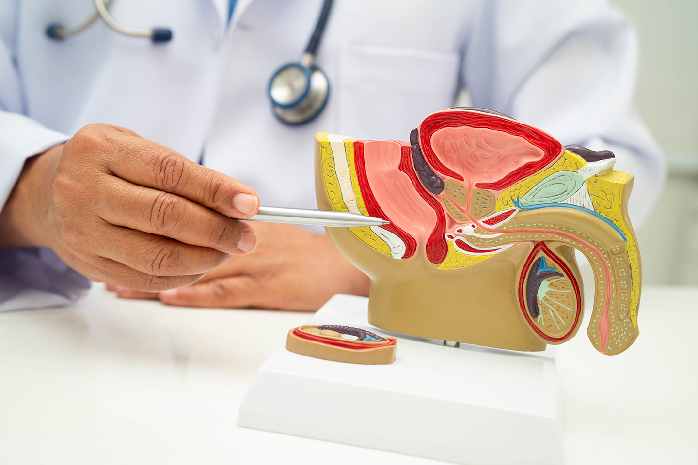 Doctor pointing to model of male reproductive system
