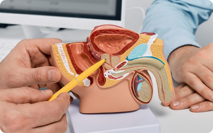 Benign Prostatic Hyperplasia (BPH) Treatment in Singapore – Urology Practice